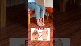 Fix Bunions the easy way 💪🙏 bunions howto shortsfeed shortsviral [upl. by Etteiluj]