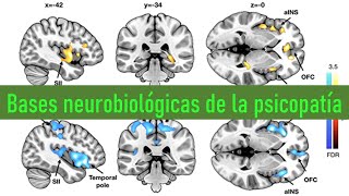 Descubren las bases cerebrales de la psicopatía  ¿Qué fallas tiene el cerebro del psicópata [upl. by Allenotna]