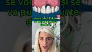 Implant versus puntea proteticacluj maradent dentist clujlife lifehacks implantdentarlife [upl. by Sadye]