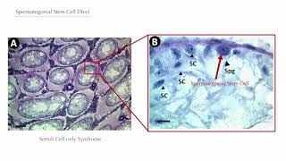 Recovery from Non Obstructive Azoospermia The Spermatogonial Stem Cell Effect [upl. by Halle]