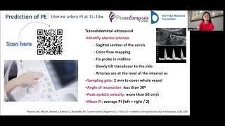 SCREENING FOR PREECLAMPSIA ISUOG [upl. by Uis]