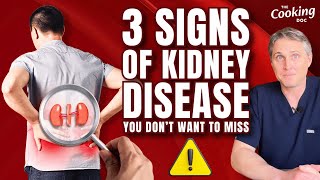 3 Signs of Kidney Disease You Dont Want to Miss [upl. by Lladnew]