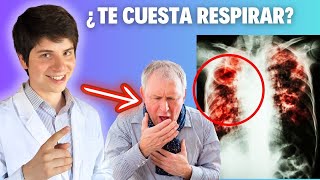 FIBROSIS PULMONAR IDIOPÁTICA ► SÍNTOMAS FISIOPATOLOGÍA DIAGNÓSTICO y TRATAMIENTO en 11 MINUTOS 😉 [upl. by Nohj]