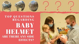 Baby Helmet for Flat Head Plagiocephaly Are There Any Side Effects [upl. by Dalohcin519]