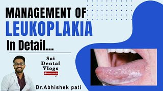 MANAGEMENT OF LEUKOPLAKIA IN DETAIL [upl. by Graces]