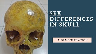 Sex Differentiation in Human Skull [upl. by Onafets]