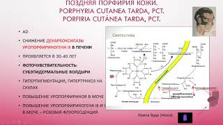 1 Поздняя порфирия кожи Porphyria cutanea tarda PCT Porfiria cutánea tarda PCT [upl. by Crespo756]