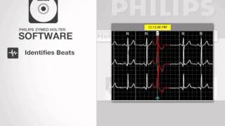 Philips Zymed Holter System Overview [upl. by Engedus]