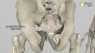 Coccyx Pain amp Ganglion Impar Block [upl. by Germain791]