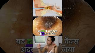 Wax nikalne ke liye Kya ear buds sahi hai  earwax earwaxremoval [upl. by Haleigh15]