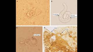 Strongyloides stercoralis  morphology life cycle pathogenesis diagnosis and treatment [upl. by Arne]