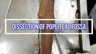 Dissection of Popliteal Fossa [upl. by Enytsuj483]