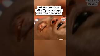 kekalahan terparah yg Mike Tyson dapatkan saat menghadapi Lennox Lewis [upl. by Asselim978]