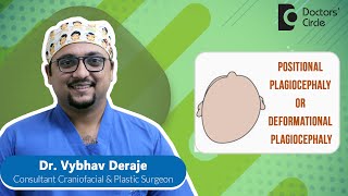 Flat Head Syndrome Plagiocephaly amp Its Treatment newborn  Dr Vybhav Deraje  Doctors Circle [upl. by Miner]