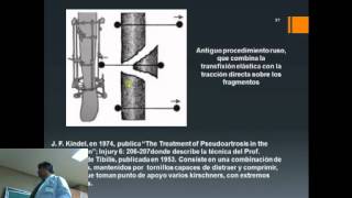 Historia de la Fijación Externa en Traumatología y Ortopedia [upl. by Aiek267]