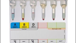 Crossmatch of blood by gel card methodhospital doctor nursing [upl. by Leaper]