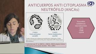 Sesión clínica ¿Pruebas reumáticas Utilidad Práctica [upl. by Devinna]