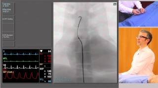 Catheterisation Left and Right Coronary Arteries [upl. by Atikcir]