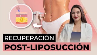 Liposucción Claves para EVITAR la FIBROSIS y prolongar los resultados [upl. by Nnanerak]