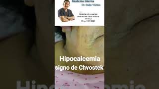 Hipocalcemia signo de Chvostek [upl. by Arbba210]