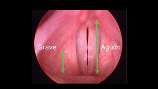 TONOS AGUDOS  MÚSCULO CRICOTIROIDEO  CRICOTHYROID MUSCLE  HIGH PITCH [upl. by Daahsar711]