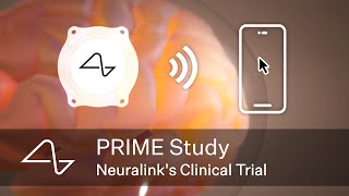 Neuralink’s Clinical Trial The PRIME Study [upl. by Cogswell637]