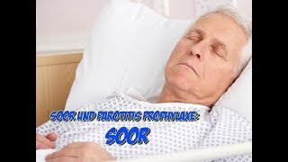 Soor und Parotitis Prophylaxe  Soor [upl. by Erme]