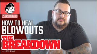 Ear Blowout  How to Heal Blowouts THE BREAKDOWN [upl. by Earehc40]