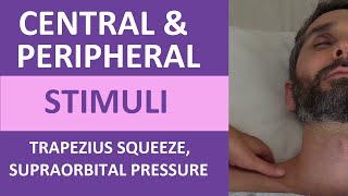 Central and Peripheral Stimuli Trapezius Squeeze Supraorbital Pressure  Nursing Neuro Assessment [upl. by Materse490]