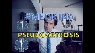 Pseudoartrosis  ROBERTO ISLAS medicina [upl. by Seldun]