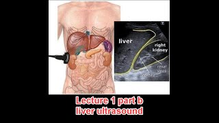 Abdominal ultrasound course  lecture 1 part b  liver د عمرو صلاح [upl. by Shipley]