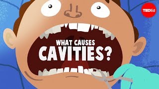 What causes cavities  aumsum kids science education children [upl. by Ellemrac]