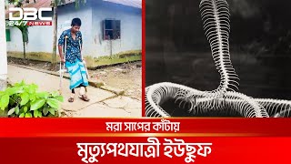 মরা সাপের কাঁটায় মৃত্যুপথযাত্রী ইউছুফ  DBC NEWS Special [upl. by Nahgrom]