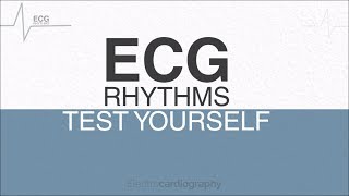 ECG Rhythms for selfassessment Test ECG Interpretation Skills [upl. by Renee]