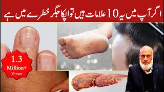 10 Signs Your Liver is in Danger  Lecture 91 [upl. by Egwin74]