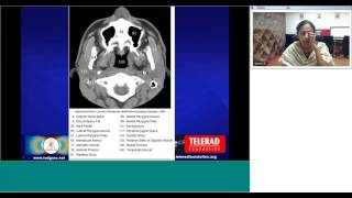 Maxillofacial CT anatomy by Dr Geetha Balasubramaniam [upl. by Maze]