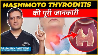 Complete Information About Hashimoto thyroiditis  Dr Gaurav Gangwami Interventional Radiologist [upl. by Atsillak]