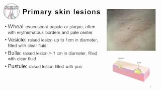 4 Primary and Secondary skin lesions [upl. by Acacia]