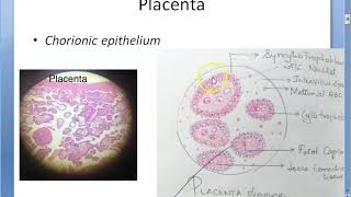 Obstetrics 243 GESTATIONAL TROPHOBLASTIC DISEASES Placental tumor Hydatidiform Mole Choriocarcinoma [upl. by Tuinenga]