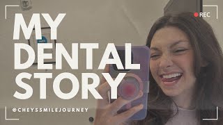 My Denture Story with Thats My Beauty before implants [upl. by Acirfa]