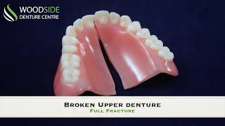 Denture Repair in Airdrie AB  Woodside Denture Centre [upl. by Berthoud]