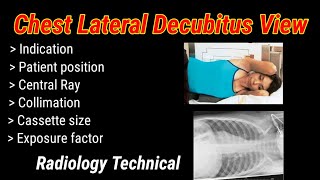 Chest lateral Decubitus View  Right amp Left decubitus  By BL Kumawat [upl. by Llerred]