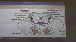 Neuroanatomy 41  Pons  part 3   by Dr Wahdan [upl. by Worthy]