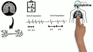 HEARTampTECHYSINUS ARRHYTHMIAECG CHANGES [upl. by Rimahs]