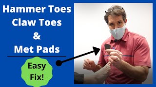 Hammer Toes Claw Toes and Met Pads Easy Fix [upl. by Grevera357]