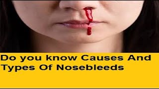 Do you know Causes And Types Of Nosebleeds [upl. by Ossy181]