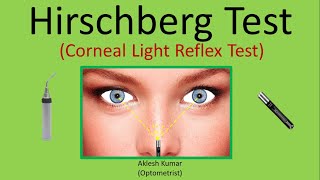 Hirschberg Test  Corneal Light Reflex Test  CLR  HBRT [upl. by Iey]