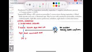 Kussmauls sign cardiology 116 First Aid USMLE Step 1 in UrduHindi [upl. by Millburn]