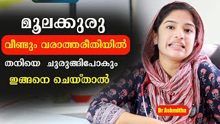 മൂലക്കുരു വീണ്ടും വരാത്തരീതിയിൽ തനിയെ ചുരുങ്ങിപോകും ഇങ്ങനെ ചെയ്താൽ Dr Ashmitha [upl. by Ecenahs]