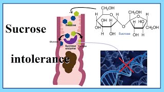 sucrose intolerance [upl. by Standush]